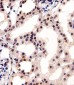 CSNK2A1 Antibody (Center)