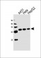 CSNK2A1 Antibody (Center)