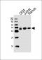 HLA-B Antibody (N-term)