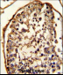 TBB5 Antibody