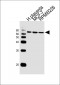 RPS6KB2 Antibody