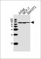 RPS6KB2 Antibody