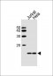 B2M Antibody