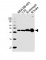 Creatine Kinase BB Antibody  (Center)