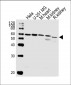 BBS4 Antibody (Center)