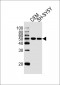 GATA3 Antibody (Center)