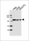 STAT3 Antibody