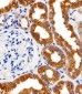 PAH Antibody (Center)