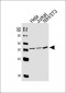 PPARA Antibody