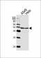 CBX8 Antibody (C-term)