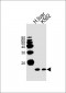 HBB Antibody (C-term)