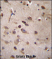 TSN Antibody (Center)