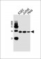 TSN Antibody (Center)