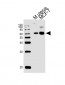 HDAC1 Antibody (N-term)