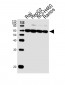 MMP3 Antibody (N-term)