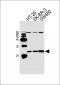 HAND1 Antibody (Center)