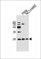 NME1 Antibody (C-term)