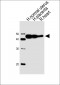 ACTA1/α-actin Antibody (C-term)