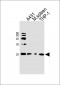 SNX3 Antibody (Center)