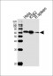 HDAC1 Antibody(C-term)