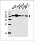 DMRTA2 Antibody (C-term)