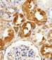 LIMK2 Antibody (C-term)