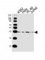 MECR Antibody (Center)
