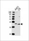 CCND1 Antibody (C-term T286)