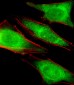 PRS4 Antibody (C-term)