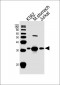 ESD Antibody (Center)