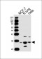 GSTM4 Antibody (N-term)