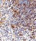 HLA-DRB1 Antibody (Center)
