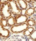 ADRA1D Antibody (N-term)