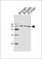 TUBA1C Antibody (N-term)