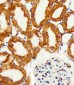 NDUFC2 Antibody (N-term)