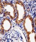 DFFB Antibody (Center)