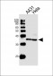 DFFB Antibody (Center)