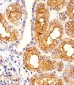 MME Antibody (Center)