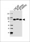 MME Antibody (Center)