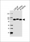 MME Antibody (Center)