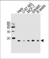UBE2D2 Antibody (N-term)