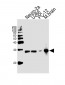 UCHL1 Antibody (C-term)