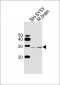 UCHL1 Antibody (C-term)