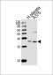 AKR1B1 Antibody (C-term)