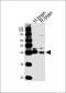 ALDOC Antibody (C-term)