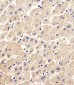 ARHGDIA Antibody (N-term)