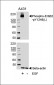 Phospho-ErbB2(Y1248) Antibody