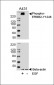 Phospho-ErbB2(Y1248) Antibody