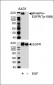 Phospho-EGFR(Y1069) Antibody