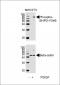 Phospho-SHP2(Y546) Antibody